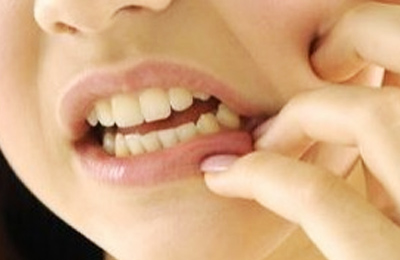 突發(fā)性、自發(fā)性的劇烈牙疼