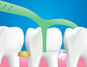 口腔問題可能要“命”！5大預警信號，別忽視