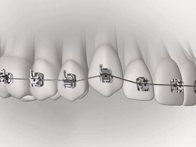 承德市哪家口腔醫(yī)院口腔正畸做得好？惟德口腔醫(yī)院來告訴您