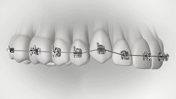 承德市哪家口腔醫(yī)院口腔正畸做得好？惟德口腔醫(yī)院來(lái)告訴您