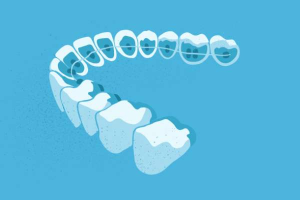 惟德口腔醫(yī)院口腔正畸好不好？